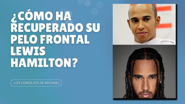 Cómo ha recuperado Lewis Hamilton su pelo frontal
