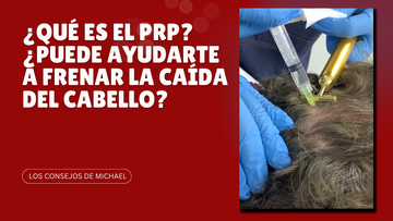 ¿Qué es el PRP? ¿Puede ayudarte a frenar la caída del cabello?