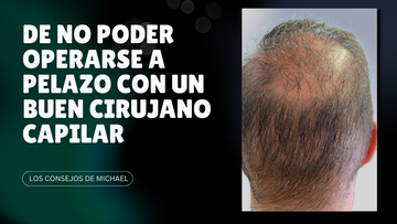 De no poder operarse a pelazo con un buen cirujano capilar - Los Consejos de Michael